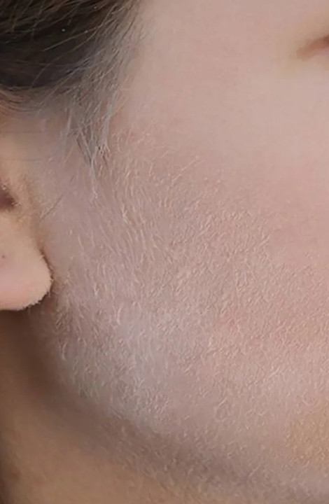 5MINSKIN ELECTRIC DERMAPLANING TOOL - 50% OFF CYBER MONDAY SALE + 3 FREE GIFTS (WORTH $112)