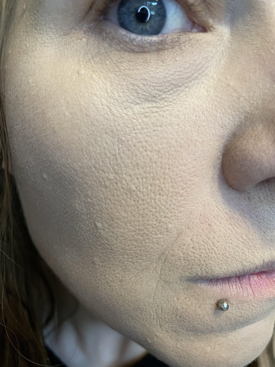 5MINSKIN ELECTRIC DERMAPLANING TOOL - 50% OFF CYBER MONDAY SALE + 3 FREE GIFTS (WORTH $112)