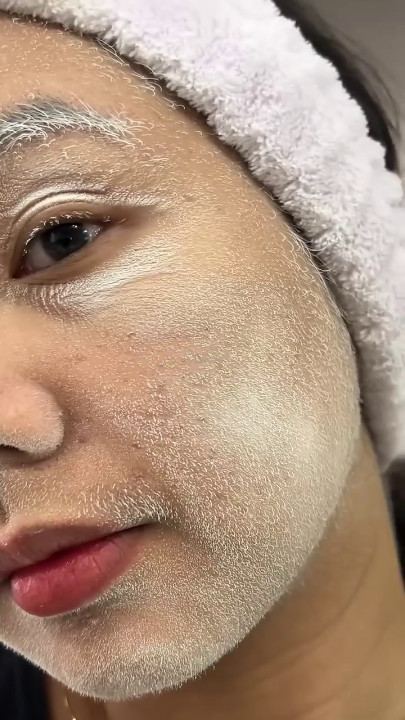 5MINSKIN ELECTRIC DERMAPLANING TOOL - 50% OFF CYBER MONDAY SALE + 3 FREE GIFTS (WORTH $112)